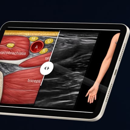 Anatomická ilustrace porovnaná s ultrazvukovým snímkem na tabletu