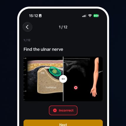 Kvíz ultrazvukové anatomie v aplikaci MSK Sono