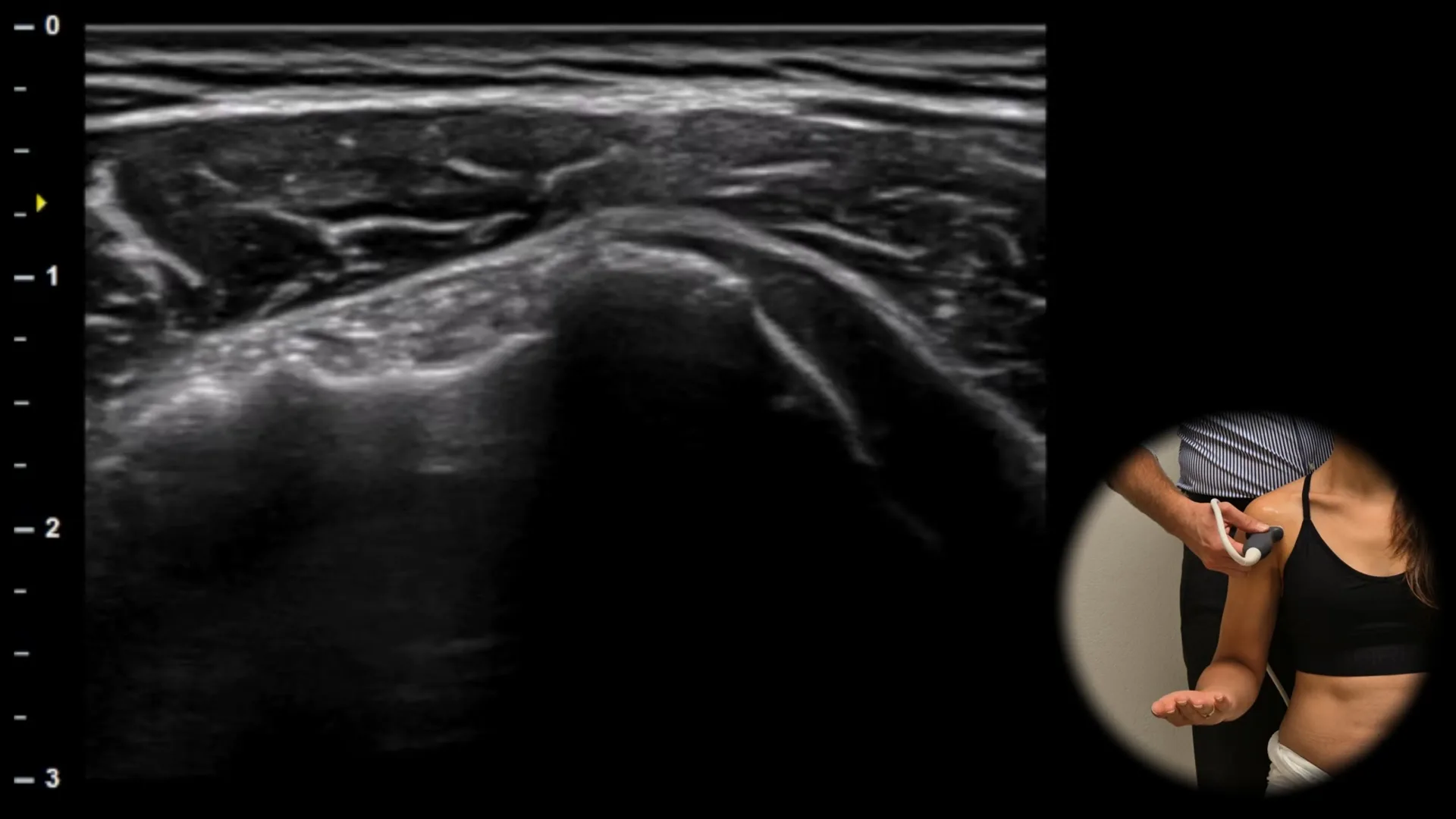 Anterior view - transverse plane