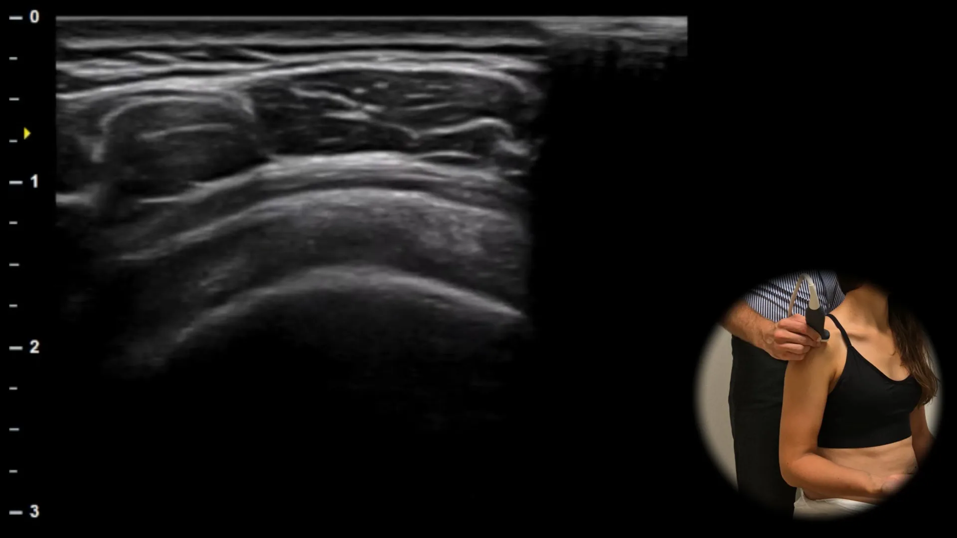 Lateral view - transverse plane