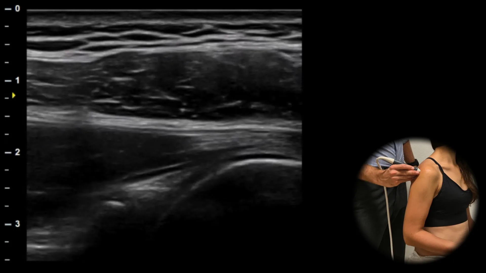 Posterior view - transverse plane