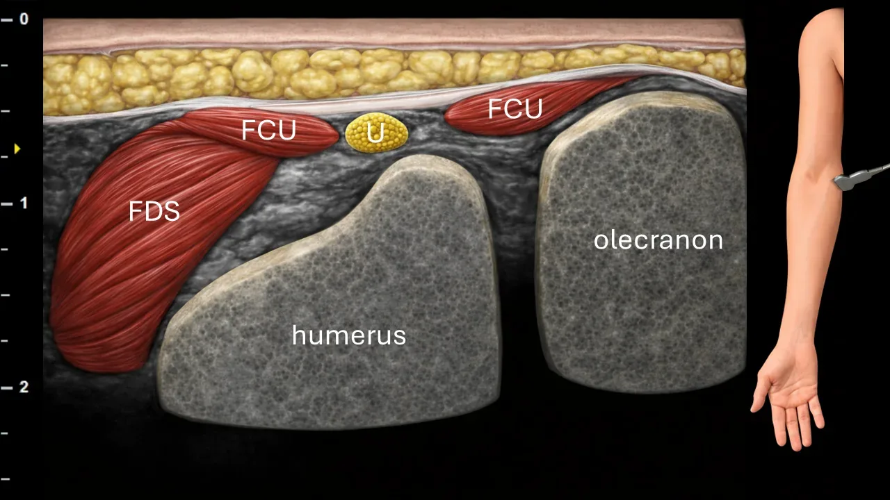 Figure 6 with labels