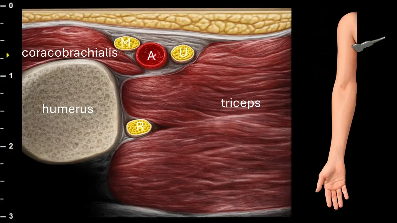 Figure 2 with labels