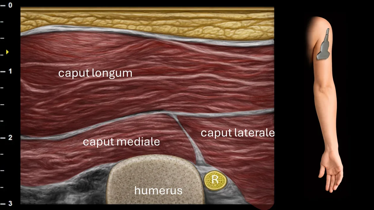 Figure 3 with labels