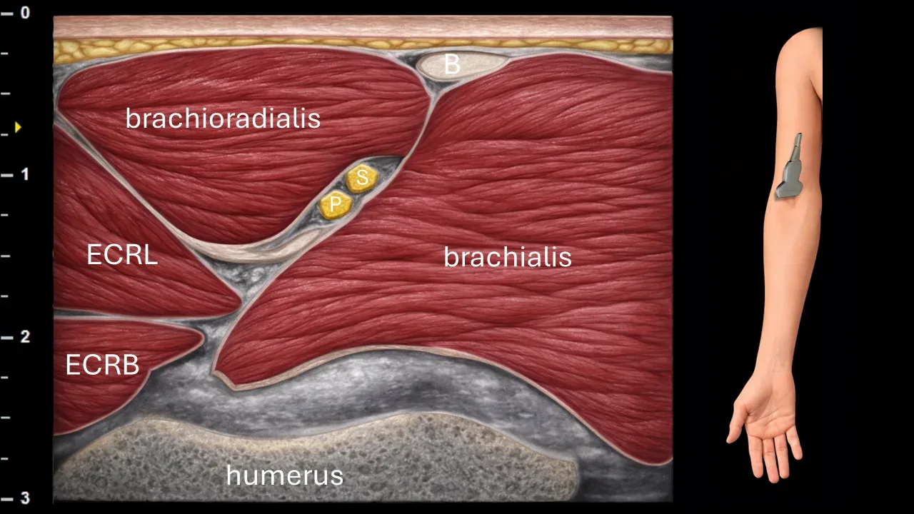 Figure 6 with labels