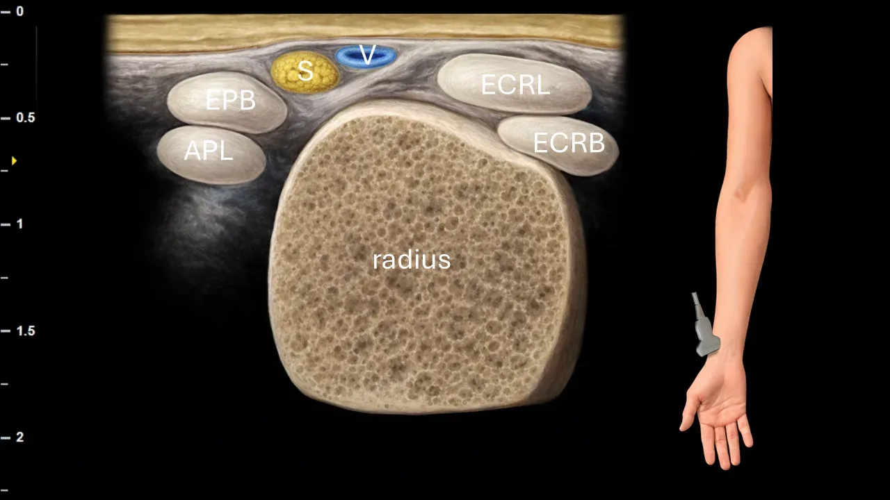 Figure 10 with labels