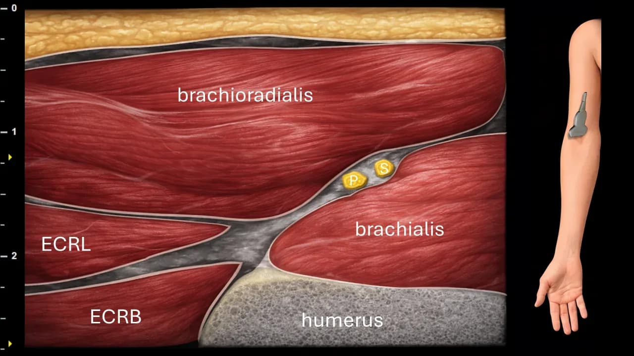 Figure 11 with labels