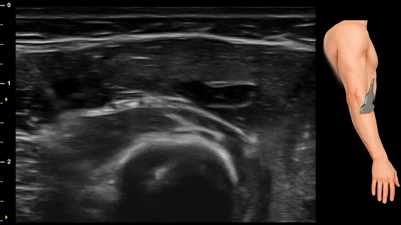 Figure 14 without labels