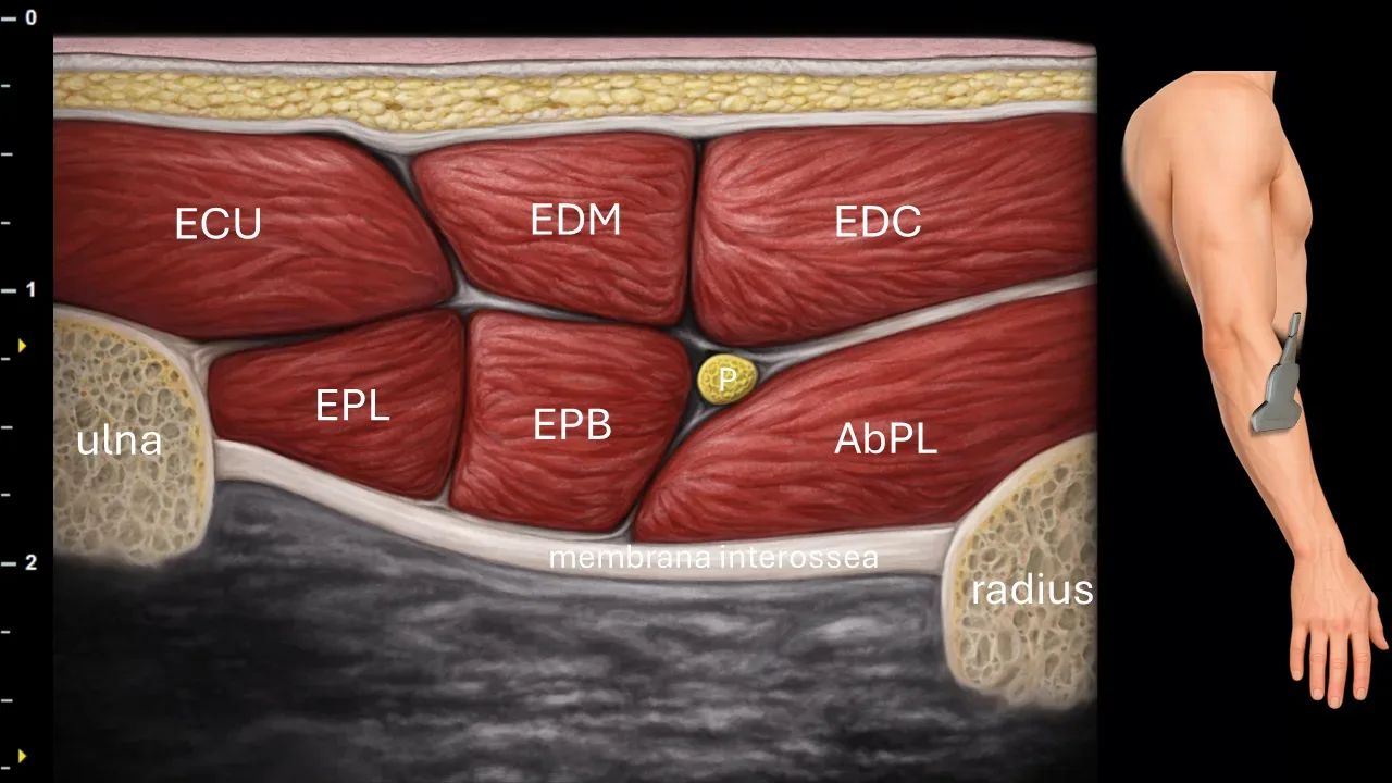 Figure 15 with labels