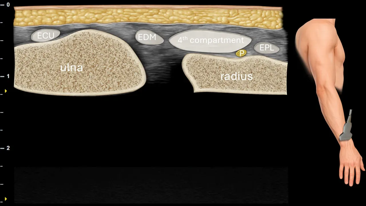 Figure 16 with labels