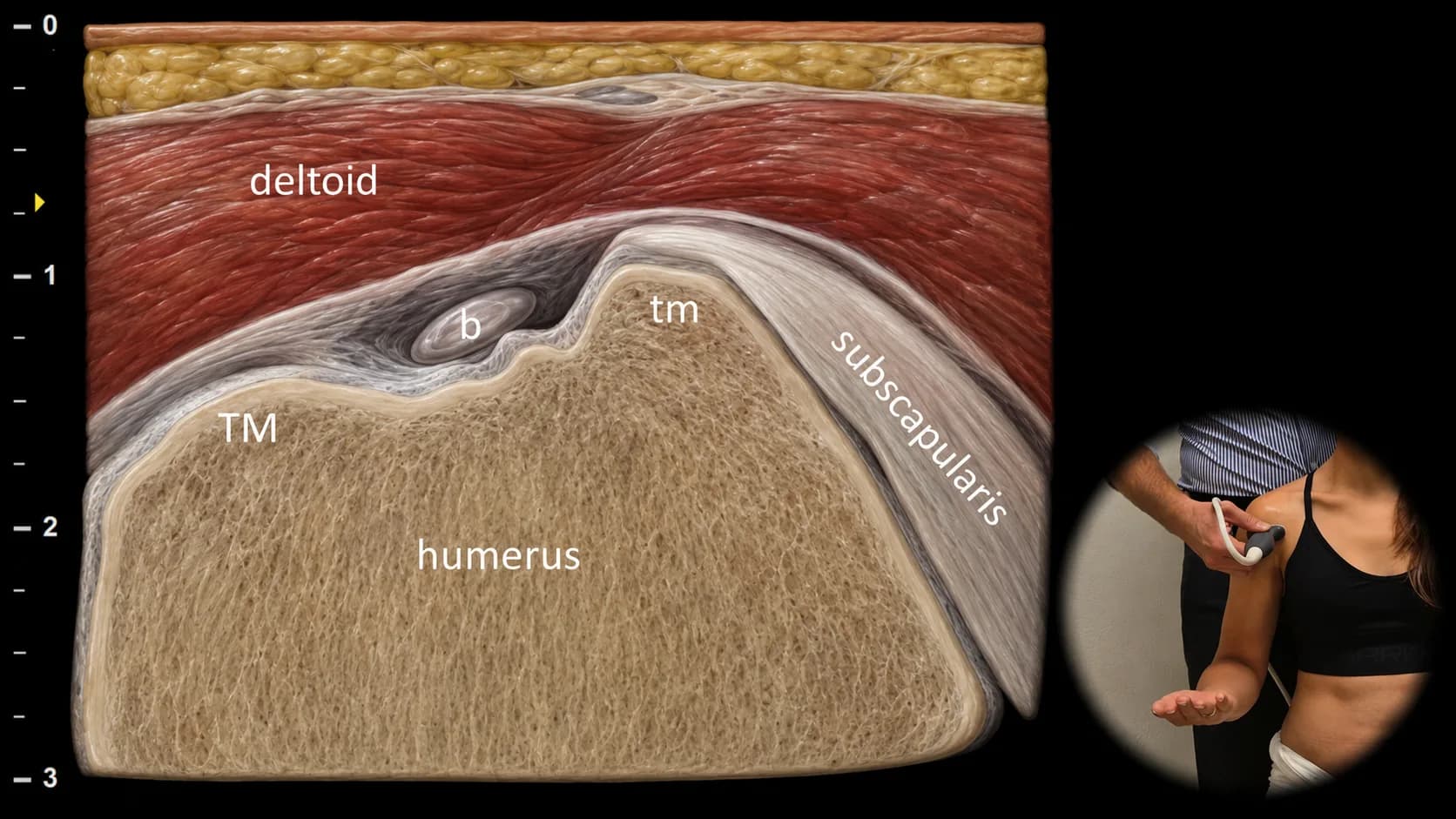 Anterior view - transverse plane
