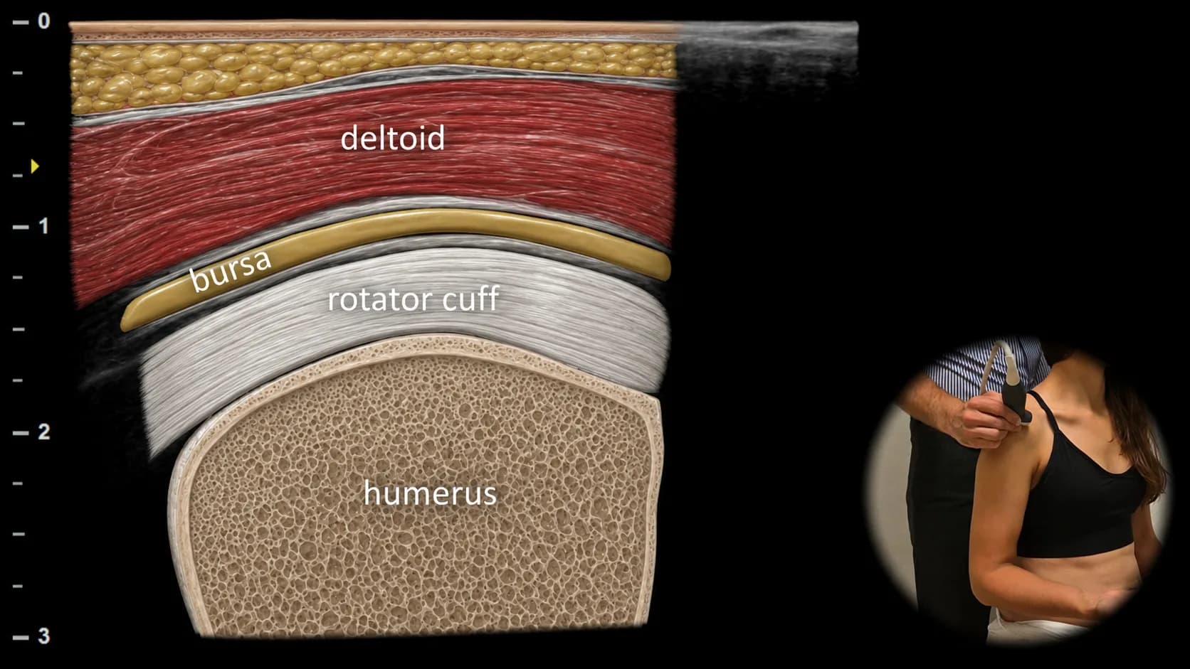 Lateral view - transverse plane