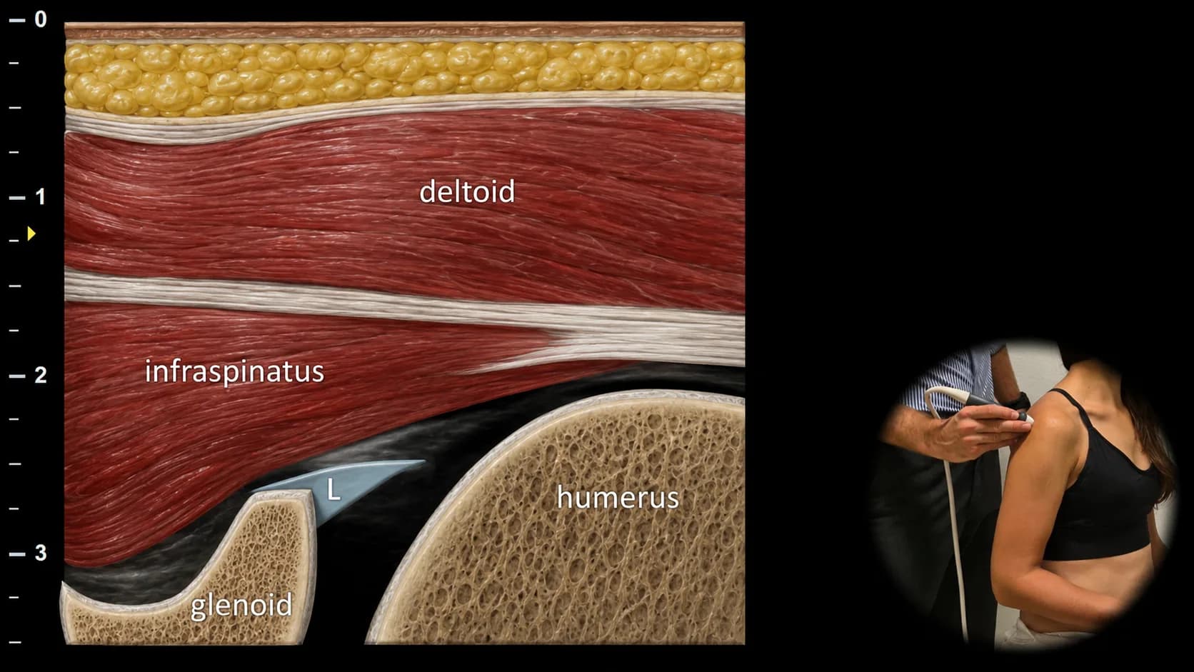 Posterior view - transverse plane