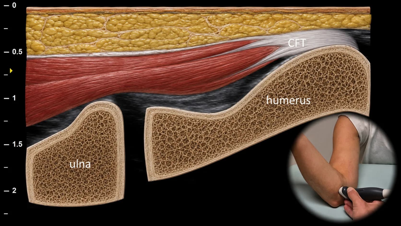 Figure 4 overlay