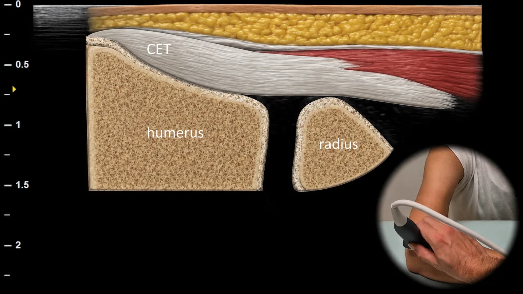 Figure 5 overlay