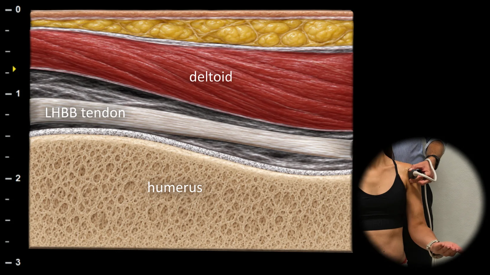 Figure 3 with labels