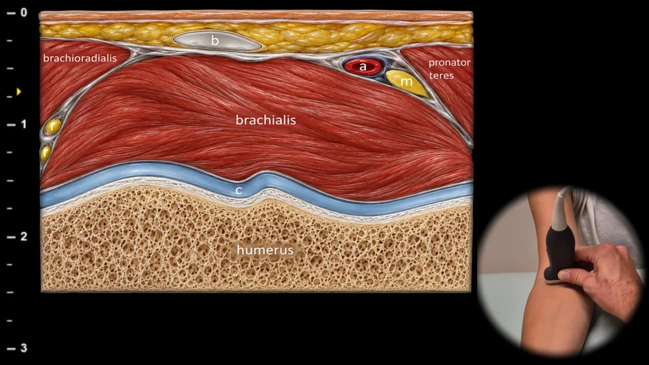 Figure 11 with labels