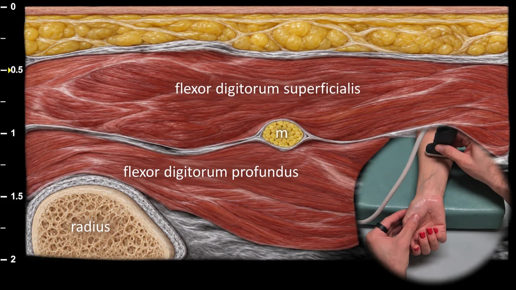 Figure 2 overlay
