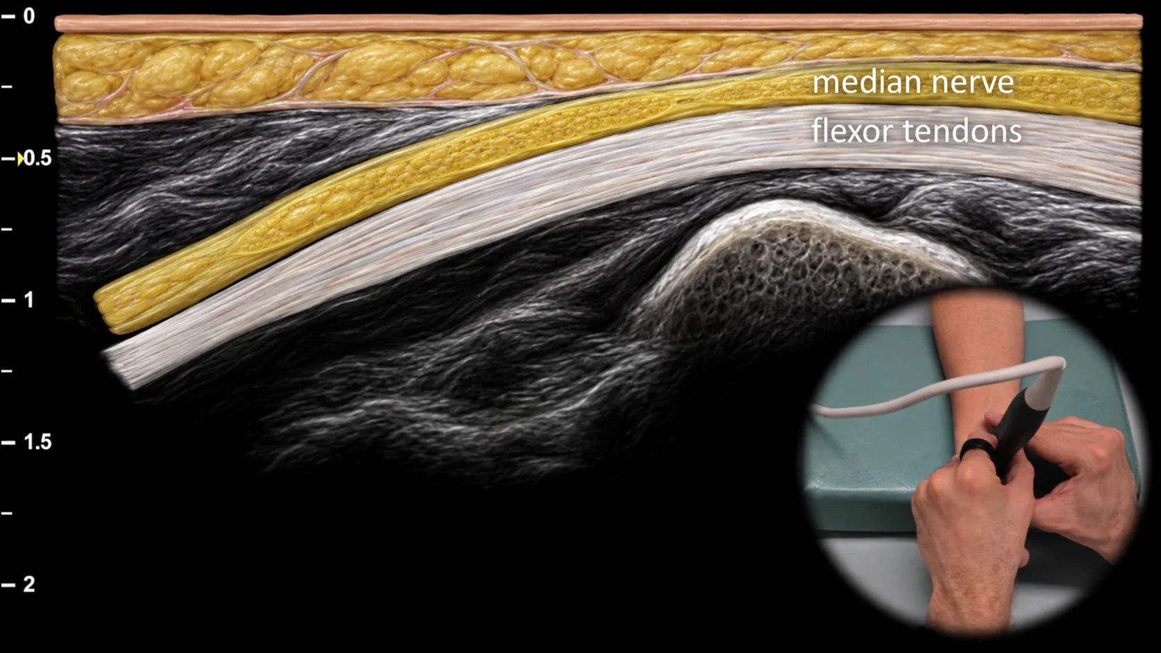 Figure 3 overlay