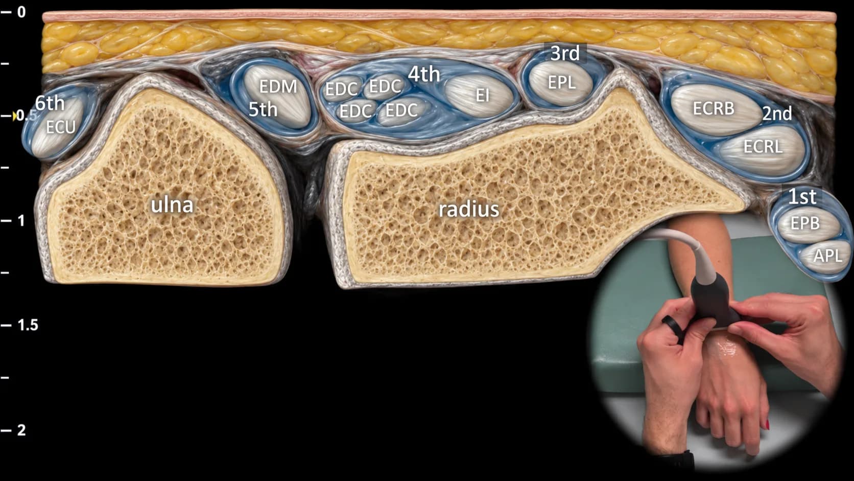 Figure 4 overlay