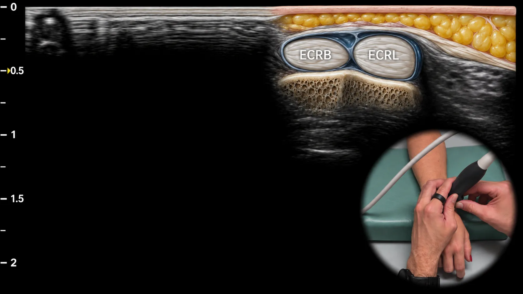 Figure 5 overlay
