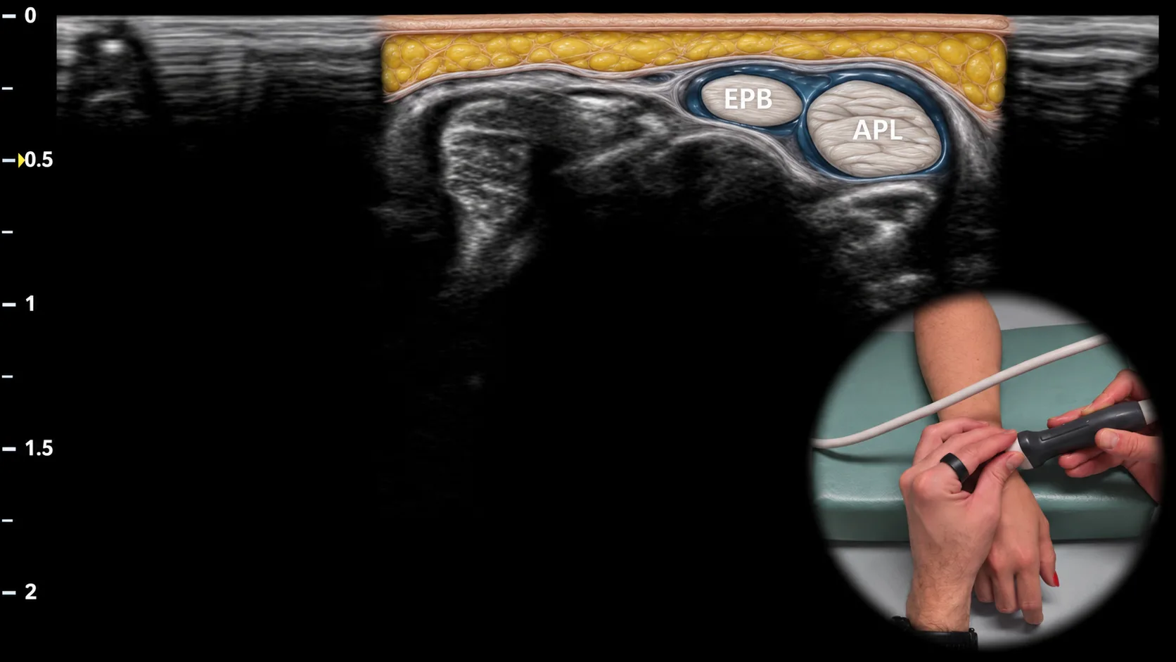 Figure 6 overlay