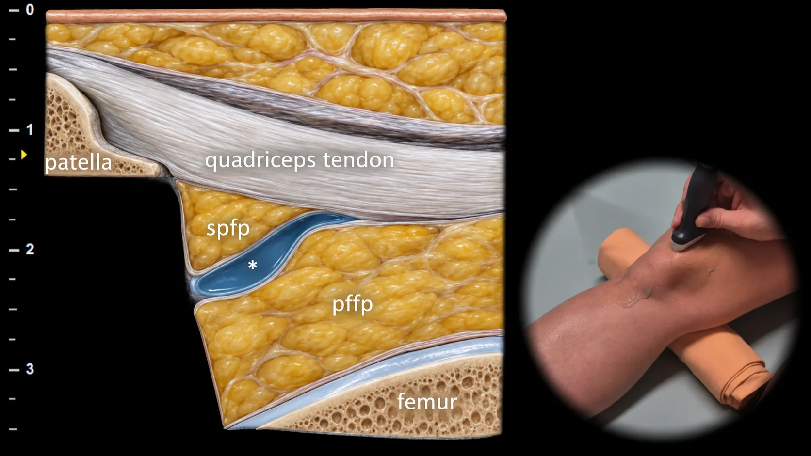 Figure 2 overlay