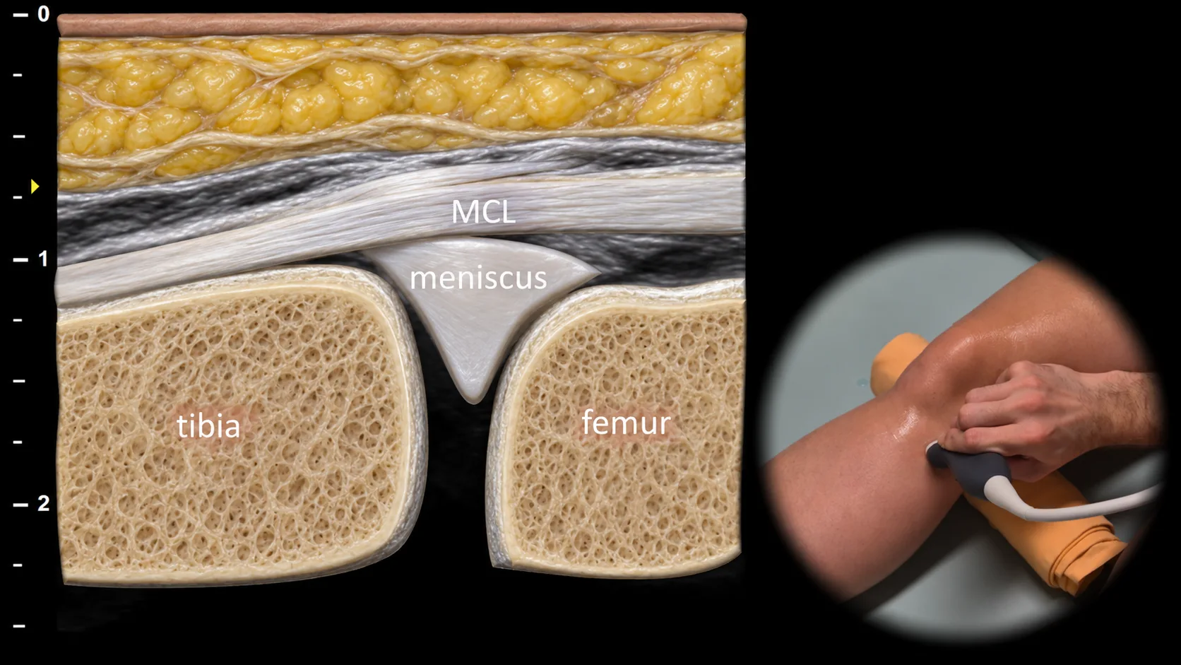 Figure 5 overlay