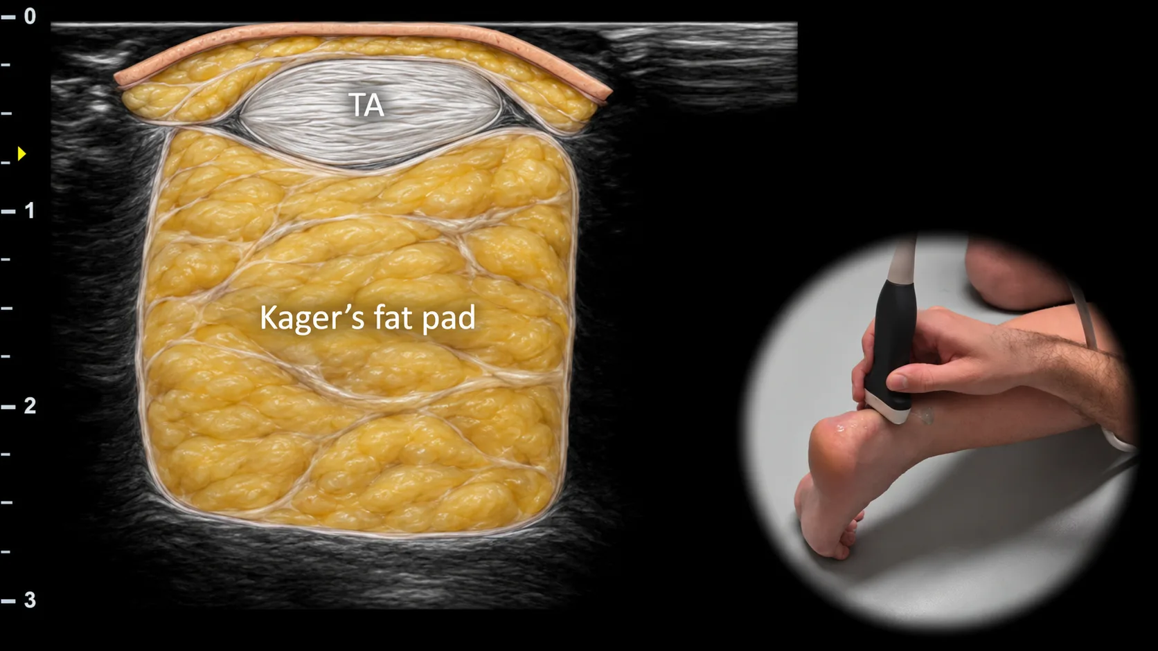 Figure 7 overlay