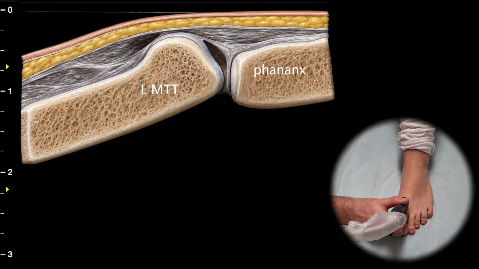 Figure 11 overlay