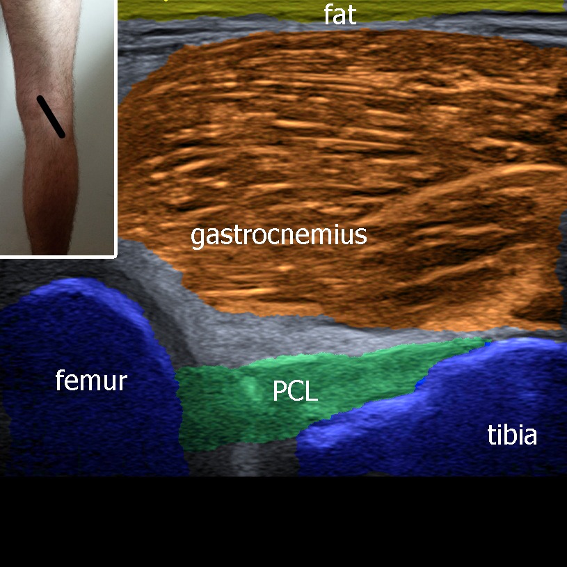 Musculoskeletal ultrasonography