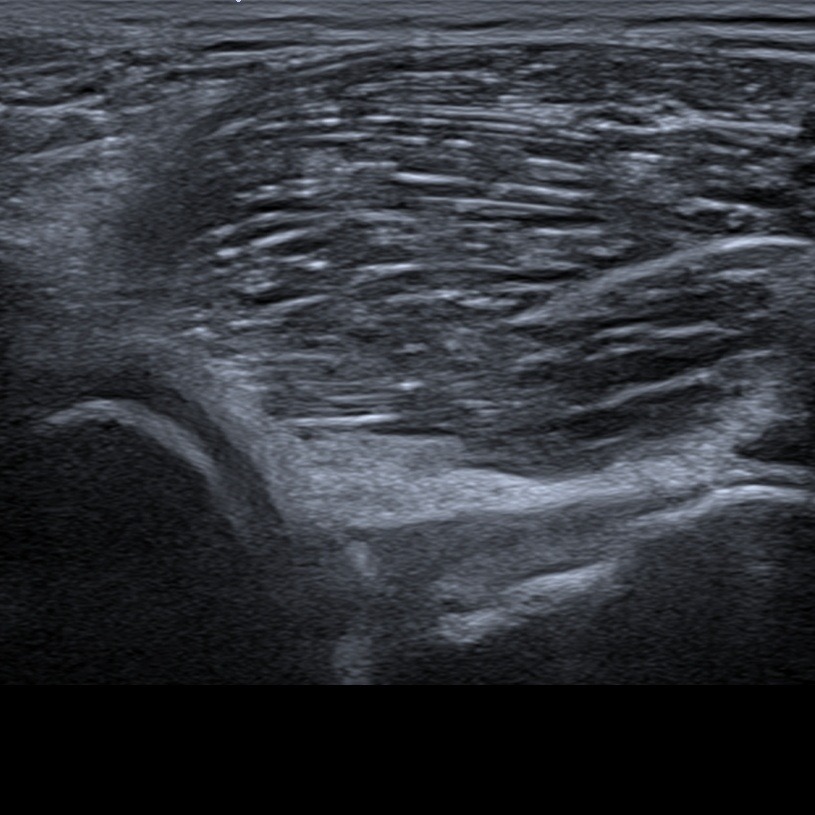 Musculoskeletal ultrasonography