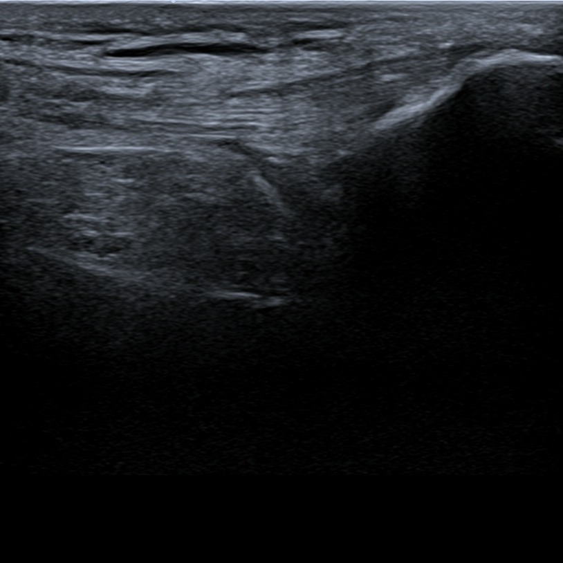 Musculoskeletal ultrasonography