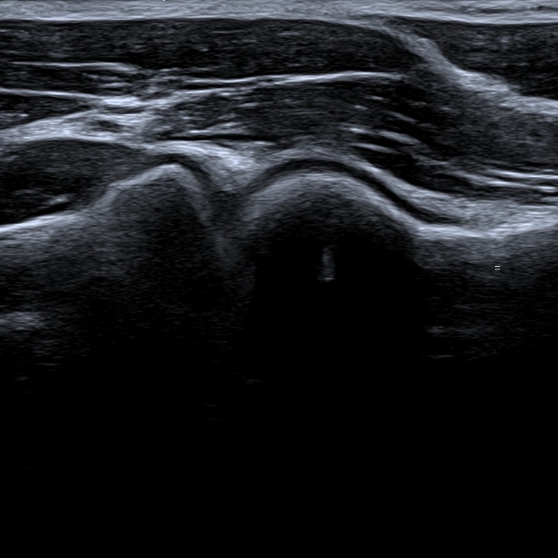 Musculoskeletal ultrasonography