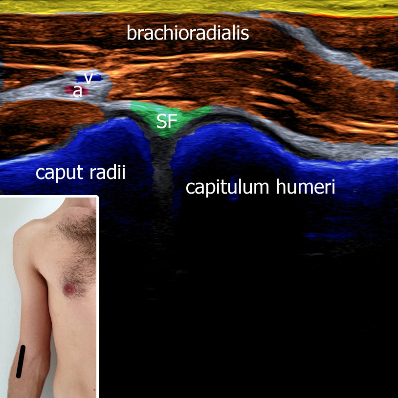 Musculoskeletal ultrasonography