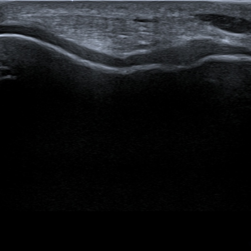 Musculoskeletal ultrasonography