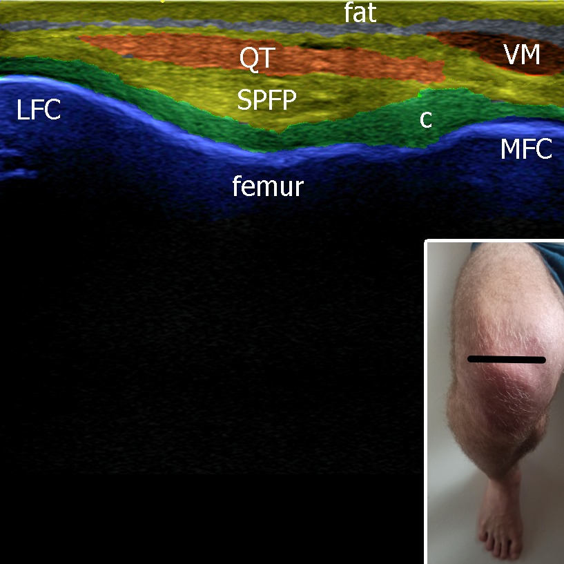 Musculoskeletal ultrasonography