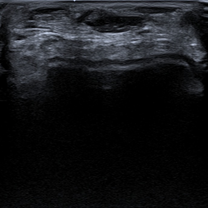 Musculoskeletal ultrasonography