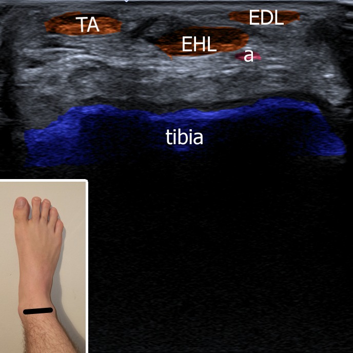 Musculoskeletal ultrasonography