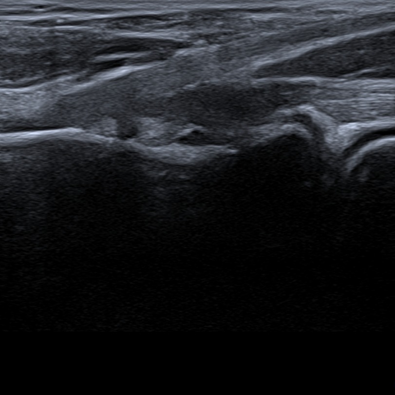 Musculoskeletal ultrasonography