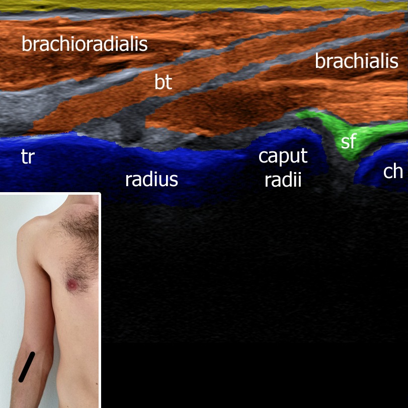 Musculoskeletal ultrasonography