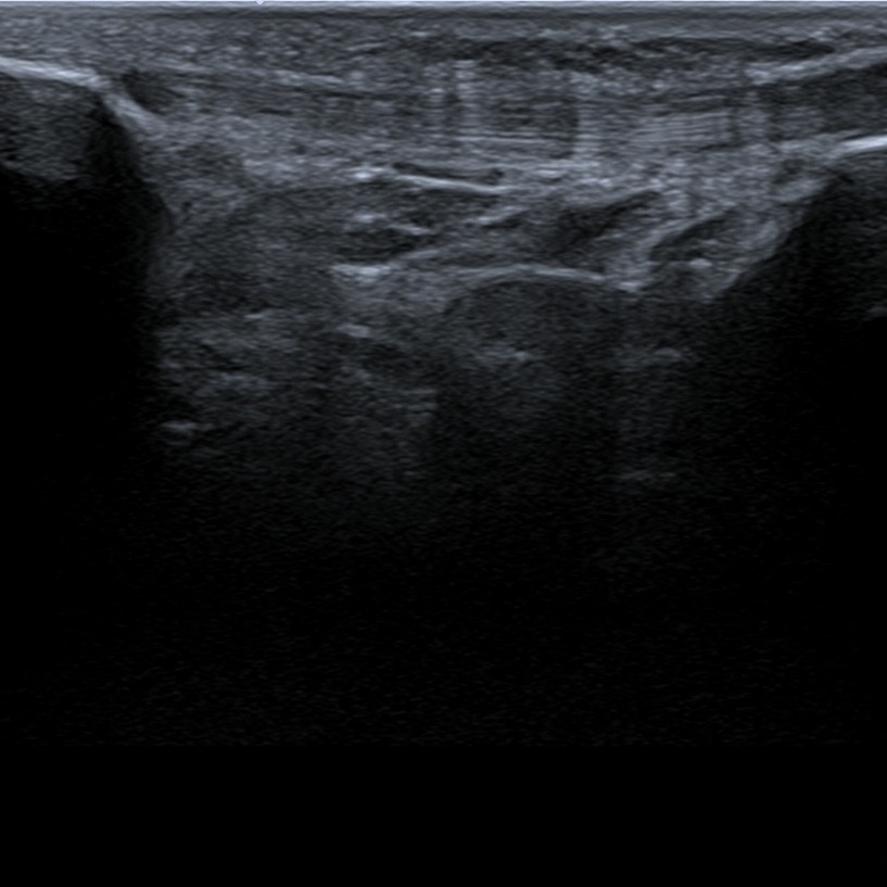 Musculoskeletal ultrasonography