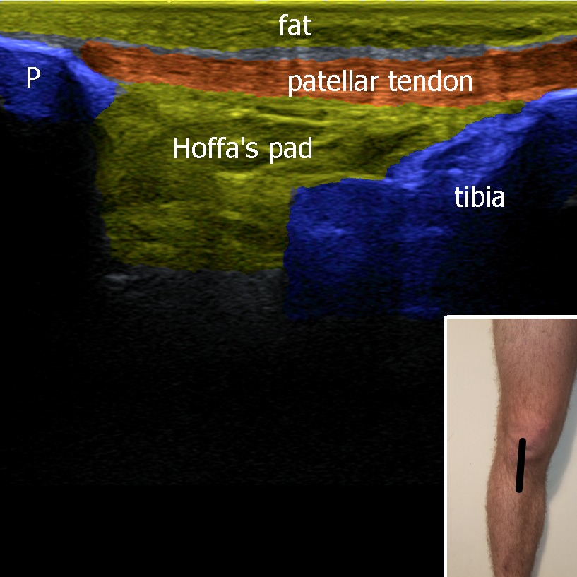 Musculoskeletal ultrasonography