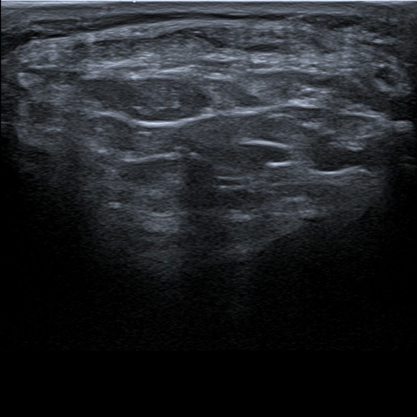 Musculoskeletal ultrasonography