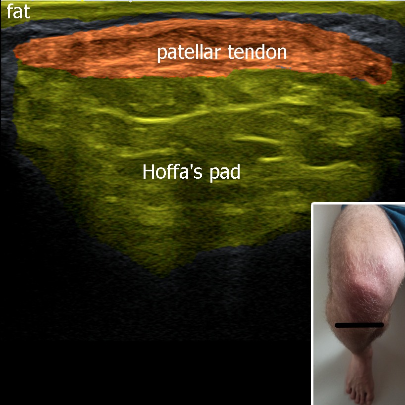 Musculoskeletal ultrasonography