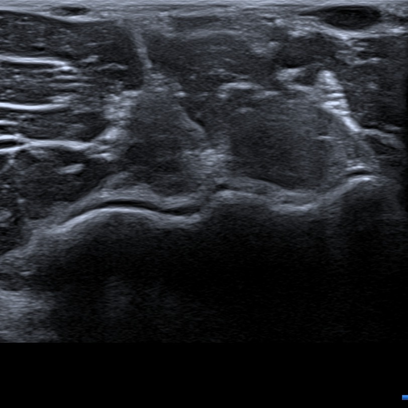 Musculoskeletal ultrasonography