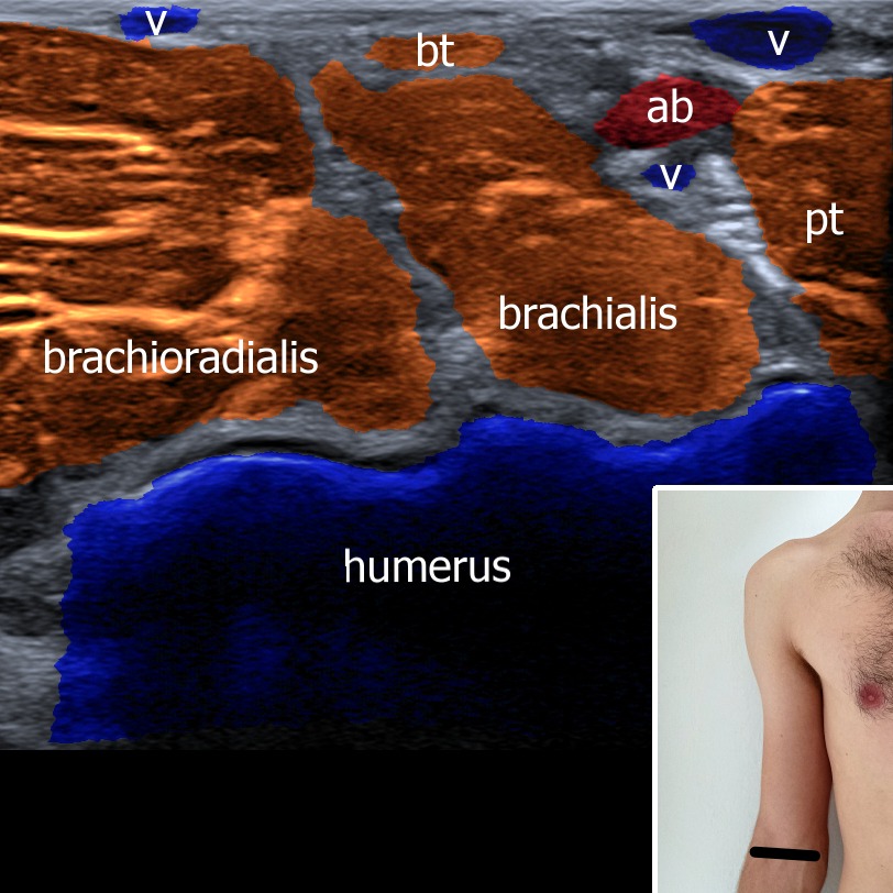 Musculoskeletal ultrasonography