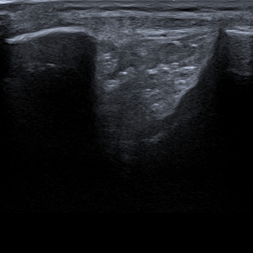 Musculoskeletal ultrasonography