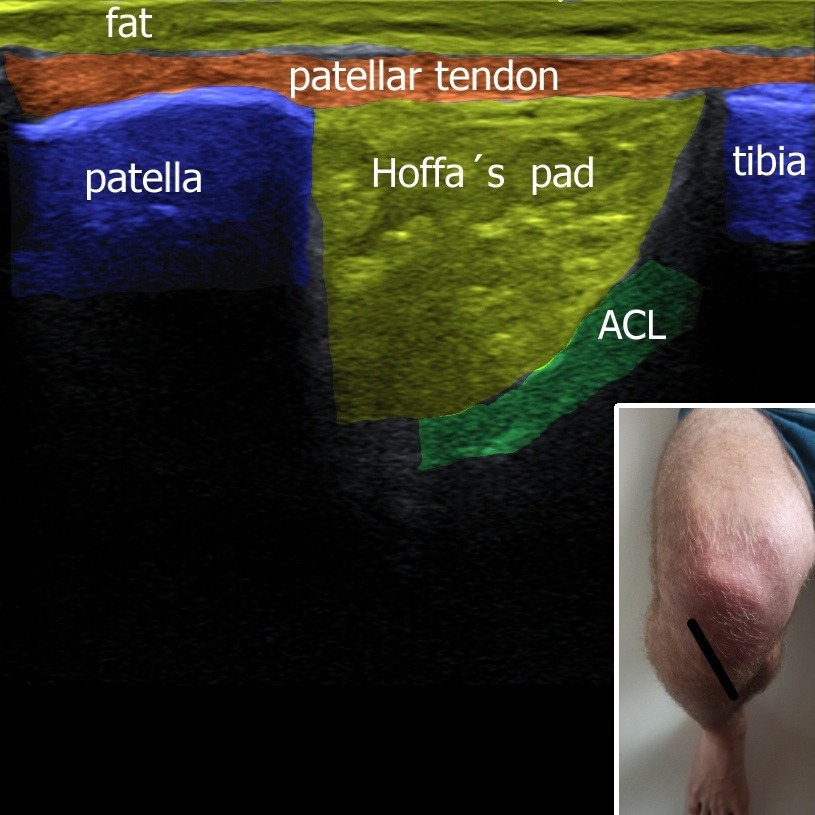 Musculoskeletal ultrasonography