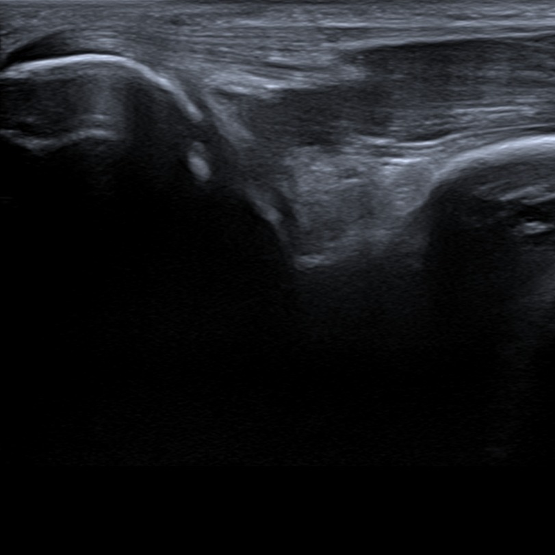 Musculoskeletal ultrasonography